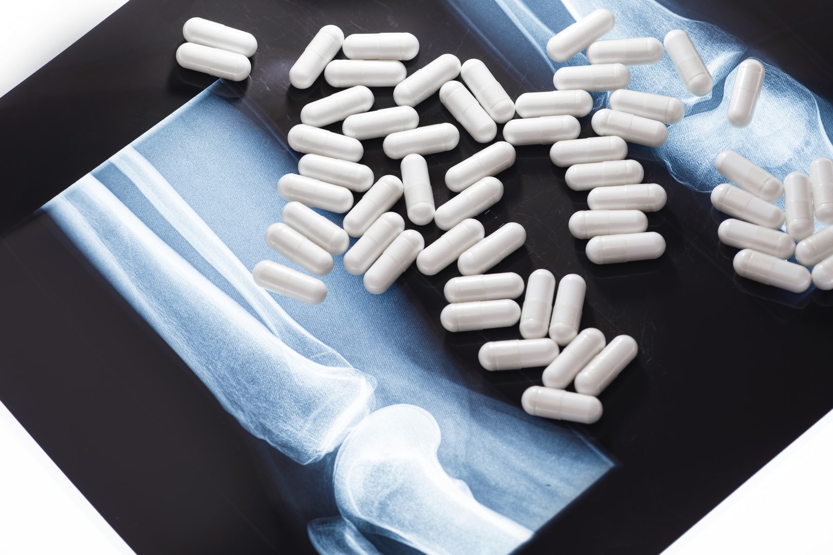 55366605-x-ray-image-and-white-capsules-with-dietary-supplement.jpg